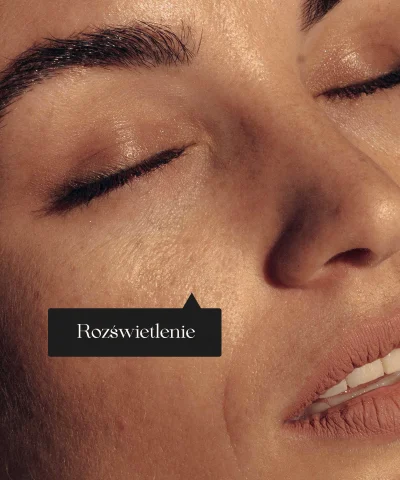 rozświetlenie